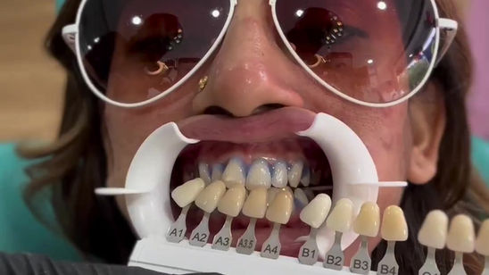 Sairiya Murugiah Getting Teeth Whitening at T.Low Dental Clinic SS2